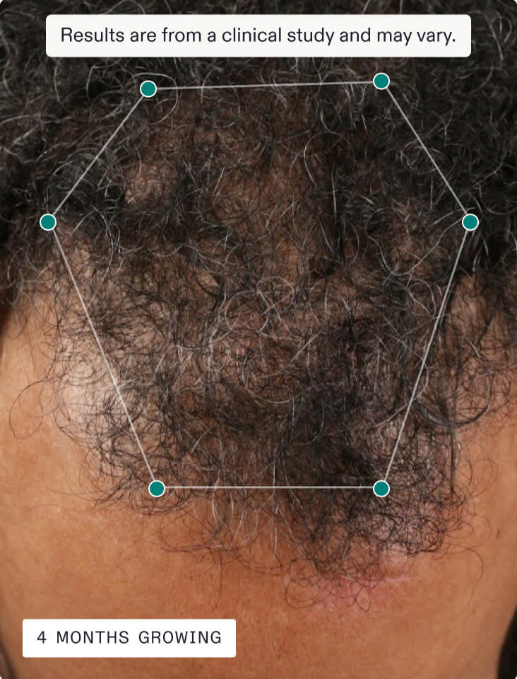 Nutrafol Men's Hair Growth Supplement - 1 Month Supply