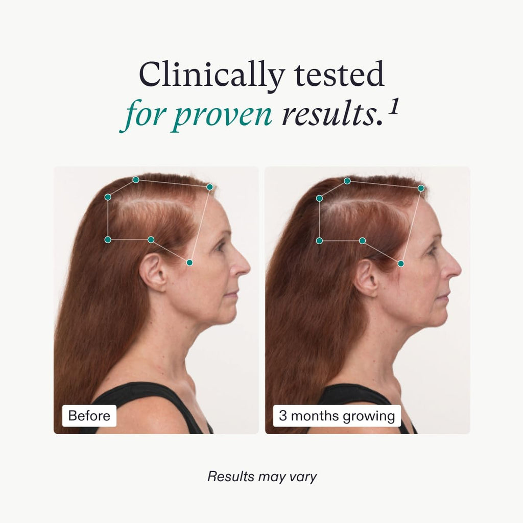Nutrafol Women’s Balance Hair Growth Supplements - 1-Month Supply